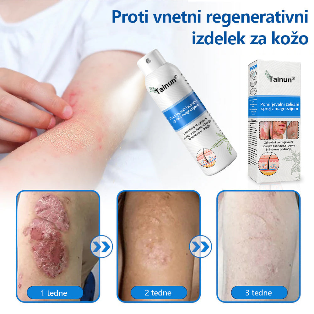 Tainun® Magnezijev zeliščni sprej ✅ CE certifikat – za zdravljenje luskavice (lajšanje luskavice in ekcemov, izboljšanje bakterijskih okužb genitalnega območja, zdravljenje aken in bradavic, lajšanje bolečin v sklepih in nevropatskih bolečin)✨
