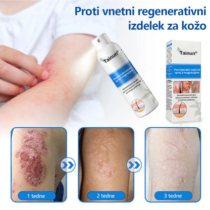 Tainun® Magnezijev zeliščni sprej ✅ CE certifikat – za zdravljenje luskavice (lajšanje luskavice in ekcemov, izboljšanje bakterijskih okužb genitalnega območja, zdravljenje aken in bradavic, lajšanje bolečin v sklepih in nevropatskih bolečin)✨