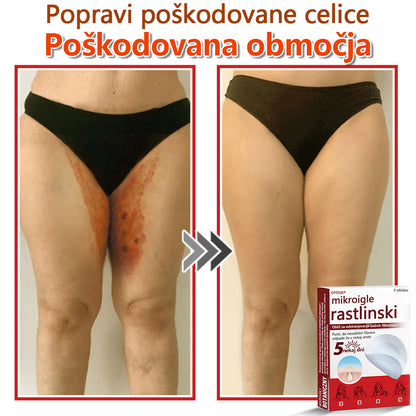 GFOUK® Rastlinski Mikronidling obliži za odstranjevanje kožnih izrastkov✨ – 🩹 Neboleče | 🚫 Brez Brazgotin | 🌿 Naravne Mikroiglice | 🎯 Globinsko Delovanje | 🛡️ Varno za Občutljivo Kožo | 📦 9 kosov | 🇪🇺 Medicinski Razred I |