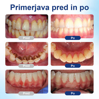 🌿🐝 Gingiora® Oral Heal Drops – naravne kapljice za nego dlesni in ustne votline | Za občutljive, razdražene in krvaveče dlesni ✨🦷