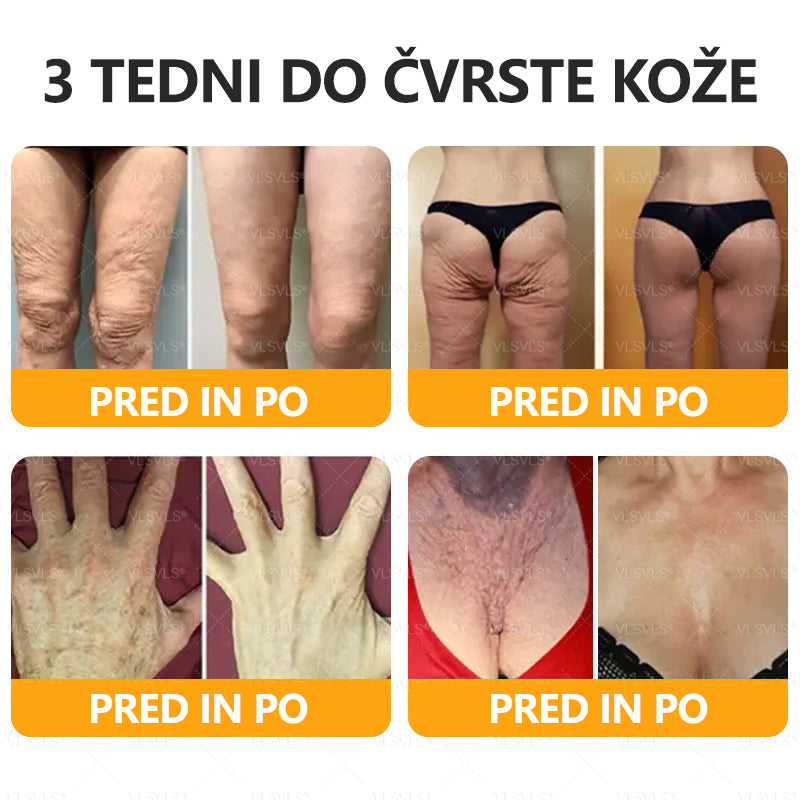 ✨ VLSVLS® Krema za obnovo kože s čebeljim strupom 🐝 Proti gubam & povešeni koži | 💆‍♀️ Učvrstitev telesa & regeneracija⚡ Vidni rezultati v 7 dneh | 💯 100% naravne sestavine |  ZADNJI DAN 80% CENEJE 🔥