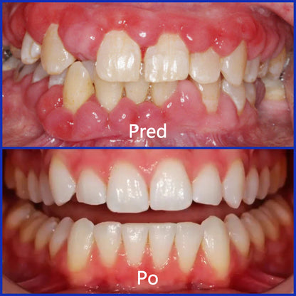 🌟 Twisma® VioCore Propolis zobna pasta 🦷 Olajšanje zobobola v 3 dneh · 7-dnevna obnova dlesni · Preprečevanje parodontalne bolezni · Popolna kombinacija čebeljega strupa in naravnih mineralov 🌟