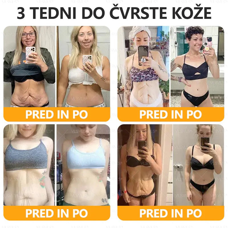 🐝🌷 Izdelano in poslano iz Slovenije – Twisma® Krema z naravnim čebeljim strupom za regeneracijo kože 🔥🔥 ZADNJI DAN – 80 % POPUST!