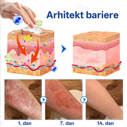 ✨ Rilua® 24H Tag- & Nacht Psoriasis System ✨ 🌿 Steroidfrei | ⚡ Anti-Juckreiz Soforthilfe Spray + 🛡️ Reparatur Balsam 💆‍♀️ Für Kopfhaut & Körper | 🔬 Dermatologisch entwickelt | 🚀 Schnelle Wirkung
