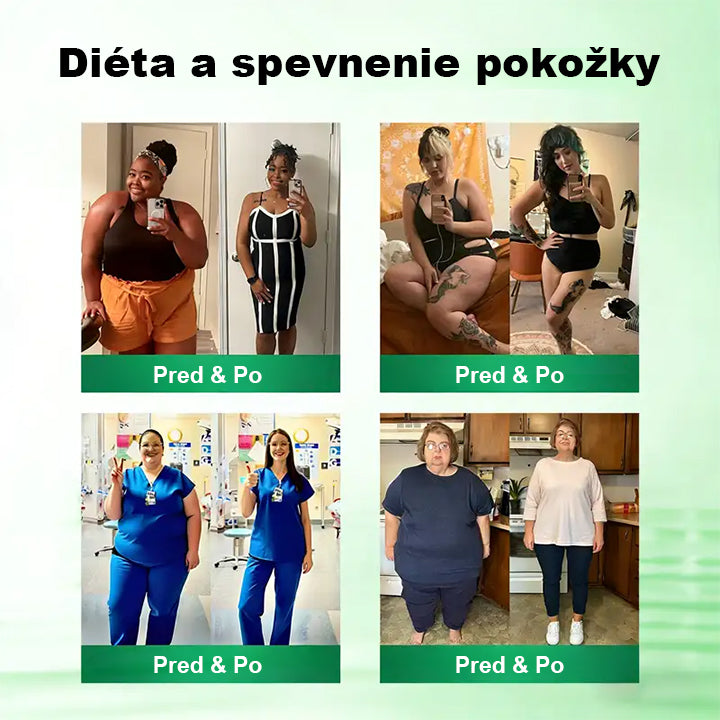 🇸🇰 Auravie® Moringa 10-v-1 Metabolický tvarujúci krém 🌸 | Transdermálna náplasť na podporu regulácie telesnej hmotnosti | Kontrola apetítu 🍽️ | Podpora spaľovania tukov 🔥 | Formovanie a spevnenie tela ✨