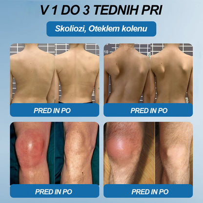🏆 | Zadnji dan akcije – 80 % POPUST | Twisma® BPC-157 krema za regeneracijo sklepov 🦴 Pomaga pri artritisu, nevropatiji, revmatizmu, športnih poškodbah in drugih težavah 🦵