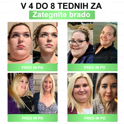 𝐆𝐞𝑒𝐿𝑒𝐦𝐨𝐧® 𝐆𝐥𝐮𝐦𝐚𝐬𝐞𝐭𝐢𝐝𝐞 8 v 1 Hujševalni in zdravju namenjen nano obliž z mikroiglicami 🇸🇮 (Samo enkrat na dan, vidne spremembe že v 7 dneh) ✅