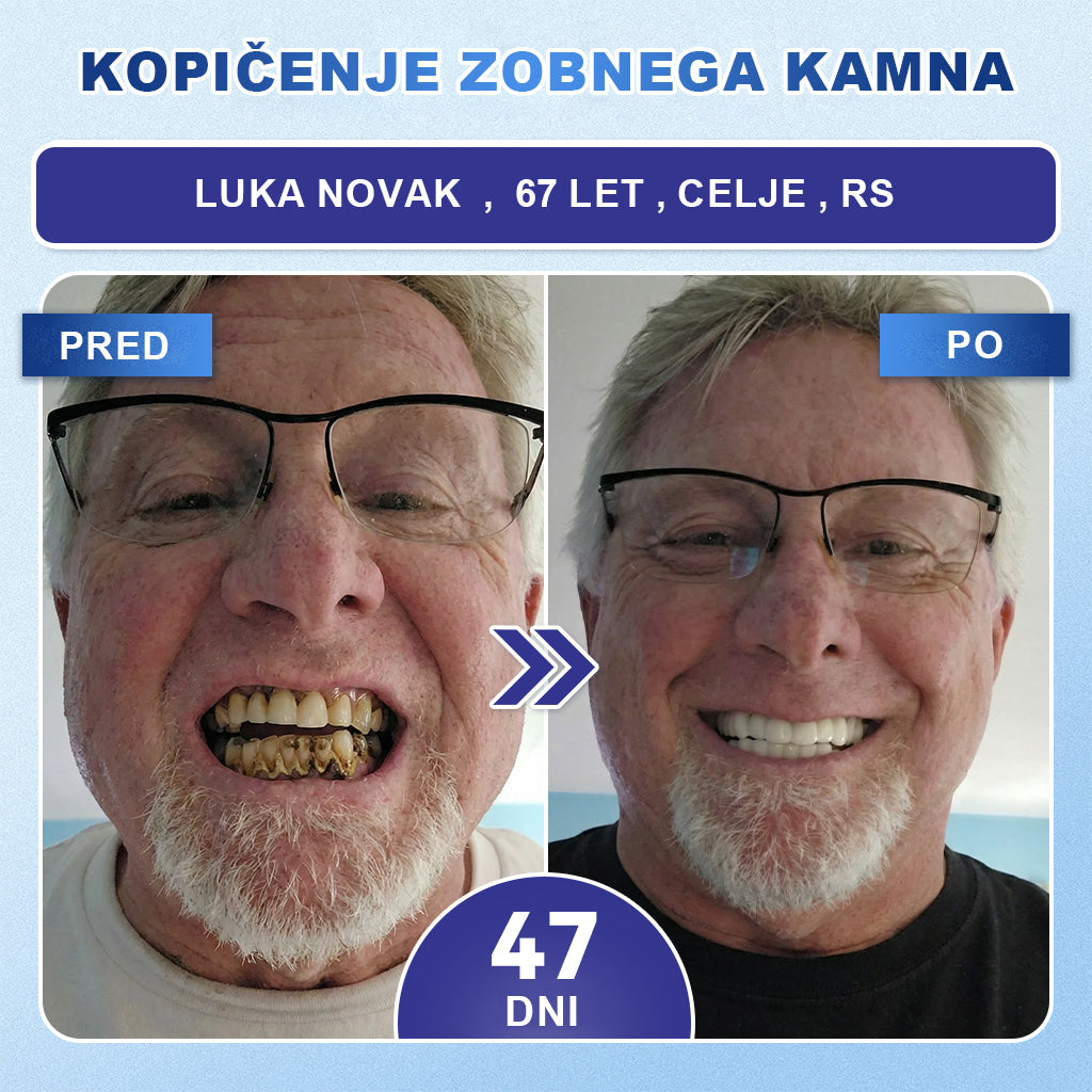 Guxar® Tideglusib Oralni Trakovi 🦷 – Aktivacija matičnih celic🧬, regeneracija dentina💎, krepitev sklenine⚡, beljenje zob✨, zmanjšanje občutljivosti💧, mikronadliki serum za zobe in dlesni💖, nežna vsakodnevna uporaba🌿