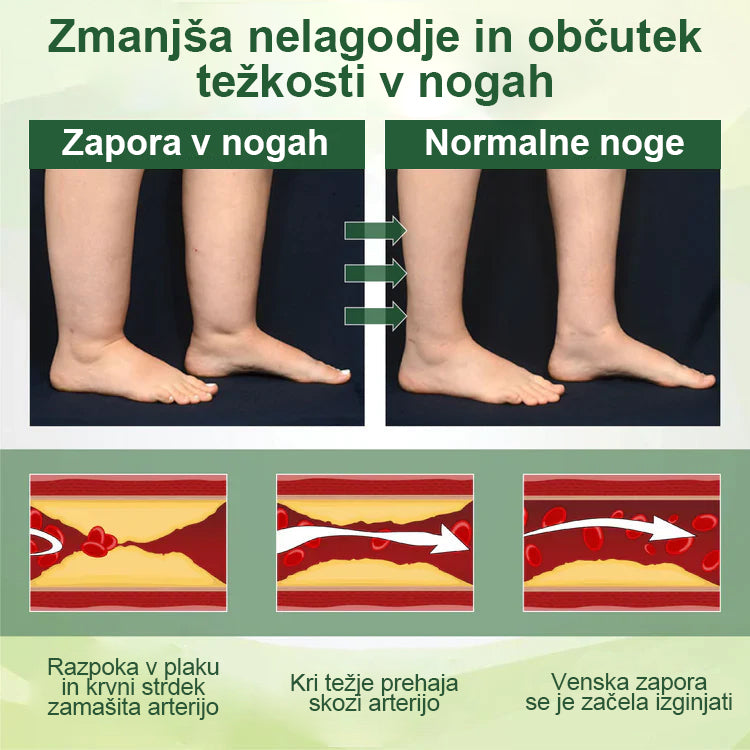 Poslovite se od otečenih, bolečih nog – Healrize® FluidEase Professional Krema za cirkulacijo nog prinaša pravo olajšanje! 🦵