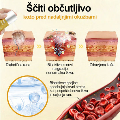 🏆 Najbolj prodajano 🔥 | Tainun® GlucoShield Čebelji strup pršilo za nego ran 🎉 Posebni časovno omejeni popust – ne zamudite!