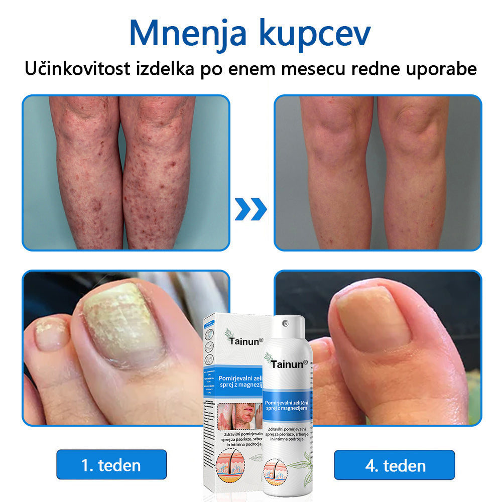 Tainun® Magnezijev zeliščni sprej ✅ CE certifikat – za zdravljenje luskavice (lajšanje luskavice in ekcemov, izboljšanje bakterijskih okužb genitalnega območja, zdravljenje aken in bradavic, lajšanje bolečin v sklepih in nevropatskih bolečin)✨