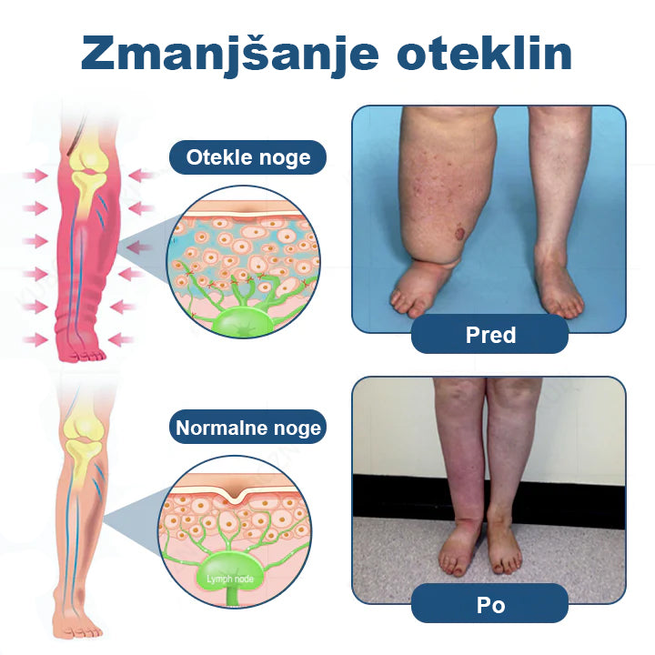 𝑳𝒖𝒙𝒂𝒓® Lymphatic Relief Roll-On – roll-on krema za otekanje nog, podporo limfni drenaži in lajšanje občutka težkih nog z masažno glavo 🌿