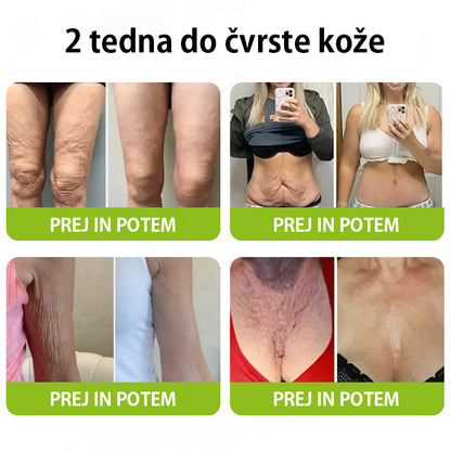 Vosxu™ Botox & Vita-A Retinol Shot serum za lifting gub ✨ – 💉 Mikro-Iglice | 💪 Peptidi z Učinkom Botoksa | 🌿 Retinol | ⚡ Vidni Rezultati v 3 Dneh