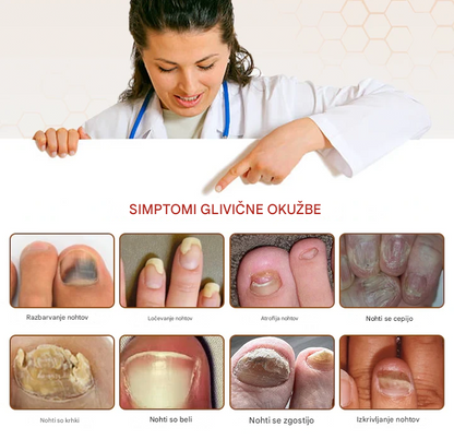 💥 2026 Omejeno 70 % CENEJE ️⏳ Hudros® NailRescue Kolirin pršilo proti glivicam s čebeljim strupom 💥 Vse težave z nohti lahko pozdravite v 2 tednih🐝