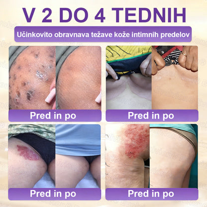 Tainun® Biotin 10-v-1 krema za obnovo kože ✨ proti staranju, luskavici, aknam, brazgotinam, pigmentaciji, suhosti, vnetjem & intimnemu nelagodju 🌿 z naravnimi bioaktivnimi sestavinami 💧 za gladko, čvrsto & mladostno kožo 🌸