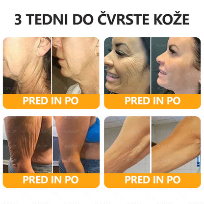 ✨ VLSVLS® Krema za obnovo kože s čebeljim strupom 🐝 Proti gubam & povešeni koži | 💆‍♀️ Učvrstitev telesa & regeneracija⚡ Vidni rezultati v 7 dneh | 💯 100% naravne sestavine |  ZADNJI DAN 80% CENEJE 🔥