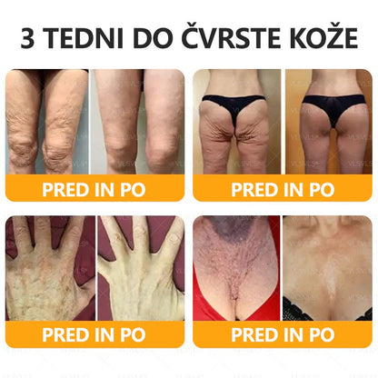 🐝🌷 Izdelano in poslano iz Slovenije – Twisma® Krema z naravnim čebeljim strupom za regeneracijo kože 🔥🔥 ZADNJI DAN – 80 % POPUST!