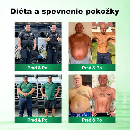 🇸🇰 Auravie® Moringa 10-v-1 Metabolický tvarujúci krém 🌸 | Transdermálna náplasť na podporu regulácie telesnej hmotnosti | Kontrola apetítu 🍽️ | Podpora spaľovania tukov 🔥 | Formovanie a spevnenie tela ✨