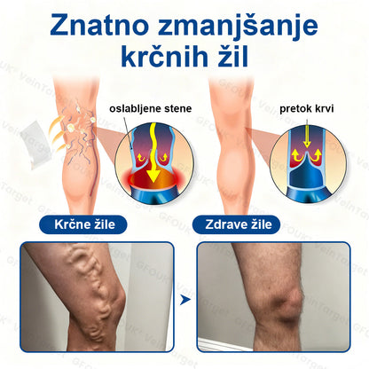 ✨ Twisma® VeinTarget: Napreden transdermalni sistem za zdravljenje kronične venske insuficience 🌿  Prvi EU-certificiran 🇪🇺 in GMP-certificiran ⚕️ alpski zeliščni mikroigelni obliž. Klinično dokazana 96-odstotna uspešnost 📊 Vidni rezultati v 7–14 dneh 🔥🔥