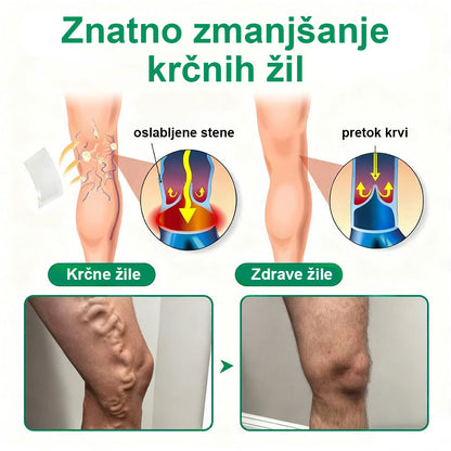 Posebna ponudba: do 70 % popusta! 🎁 Twisma® VeinTarget – napredni mikroobliž za krčne žile 🔥 96 % klinično dokazana učinkovitost ⚡ Vidni rezultati že v 7–14 dneh 🌿 Nežen podporni učinek za lažje in sproščene noge 🦵💪