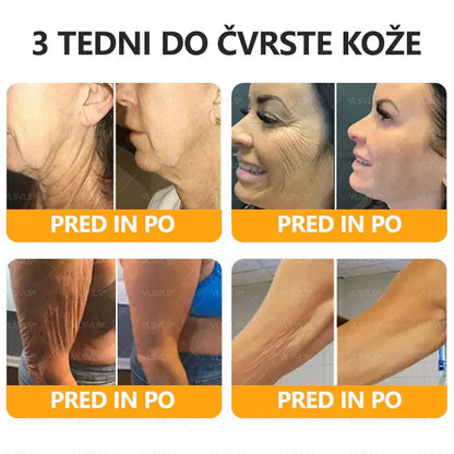 🐝🌷 Izdelano in poslano iz Slovenije – Twisma® Krema z naravnim čebeljim strupom za regeneracijo kože 🔥🔥 ZADNJI DAN – 80 % POPUST!