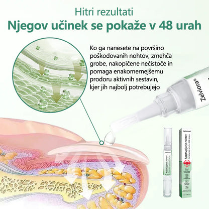 Zelviora® Serum Pen za globinsko nego in obnovo nohtov ✨ Napredna mikro-molekularna formula za obnovo nohtov 💧 Globinsko delovanje ✔️ Podpira zdravo rast nohtov ⏱️ Vidni rezultati v 7–21 dneh 🔥