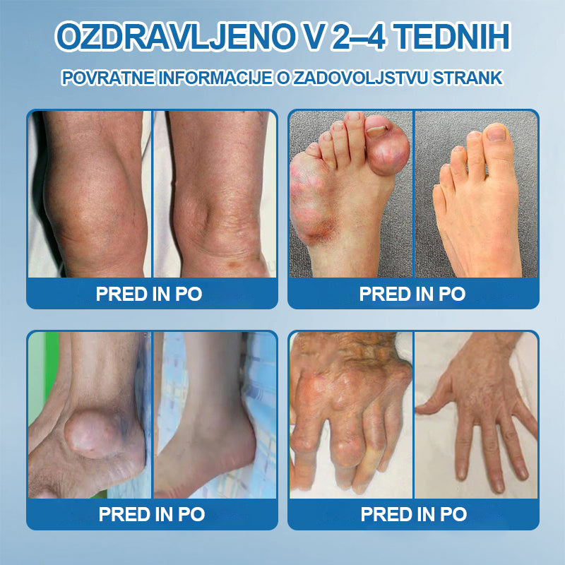 🏆 | Zadnji dan akcije – 80 % POPUST | Twisma® BPC-157 krema za regeneracijo sklepov 🦴 Pomaga pri artritisu, nevropatiji, revmatizmu, športnih poškodbah in drugih težavah 🦵