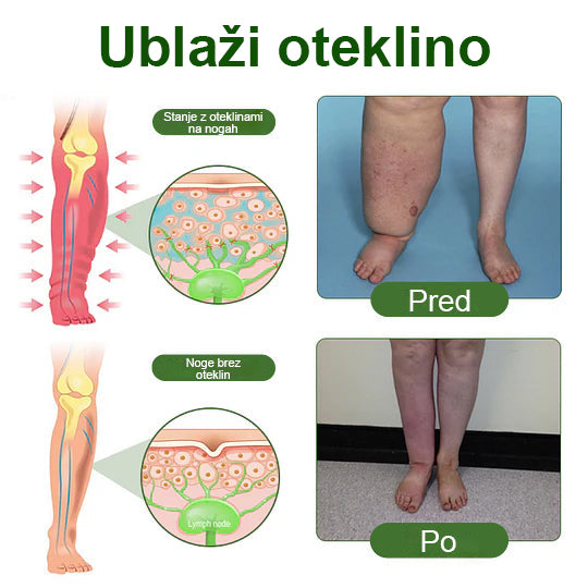 Poslovite se od otečenih, bolečih nog – Healrize® FluidEase Professional Krema za cirkulacijo nog prinaša pravo olajšanje! 🦵
