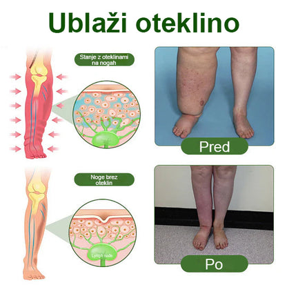 Poslovite se od otečenih, bolečih nog – Healrize® FluidEase Professional Krema za cirkulacijo nog prinaša pravo olajšanje! 🦵