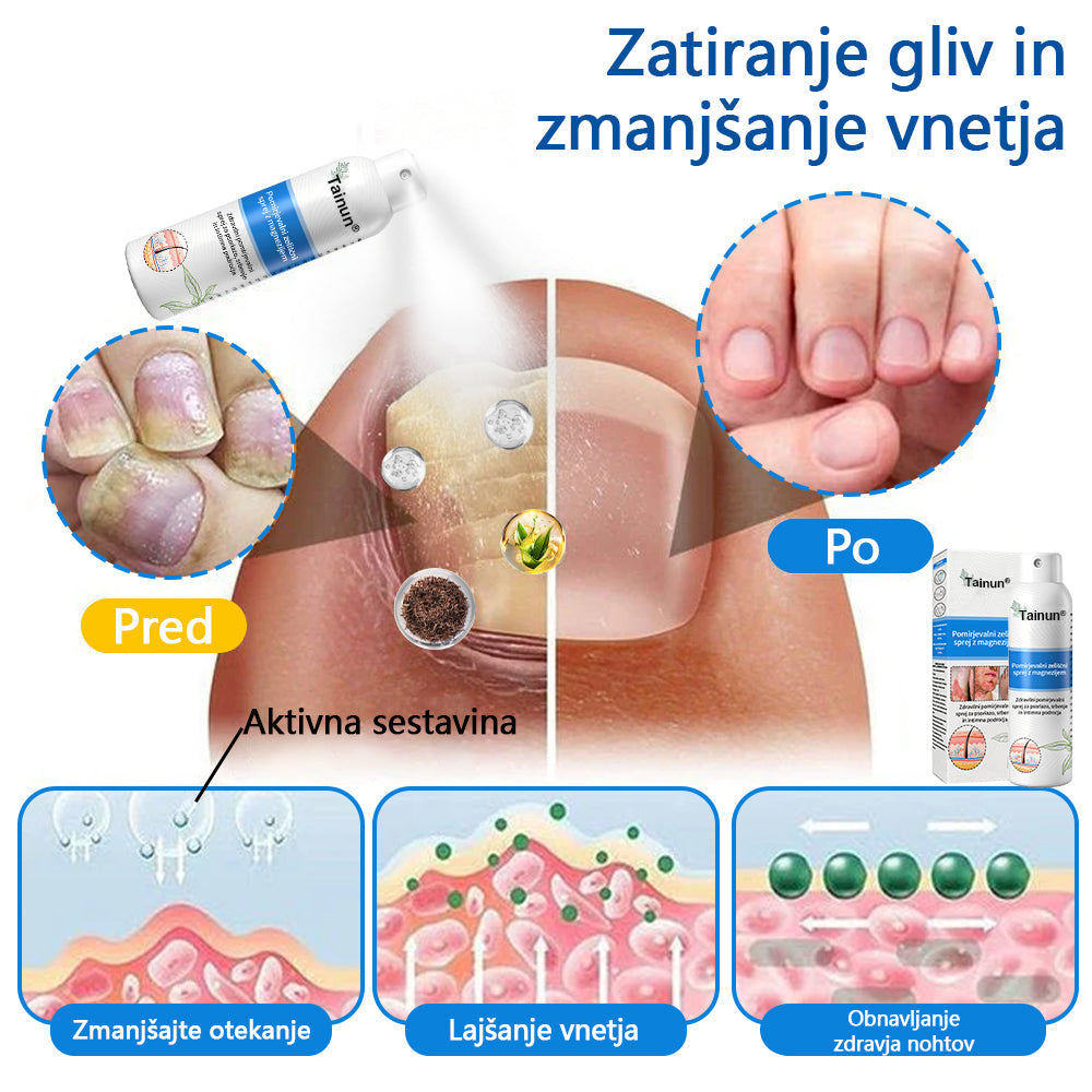 Tainun® Magnezijev zeliščni sprej ✅ CE certifikat – za zdravljenje luskavice (lajšanje luskavice in ekcemov, izboljšanje bakterijskih okužb genitalnega območja, zdravljenje aken in bradavic, lajšanje bolečin v sklepih in nevropatskih bolečin)✨