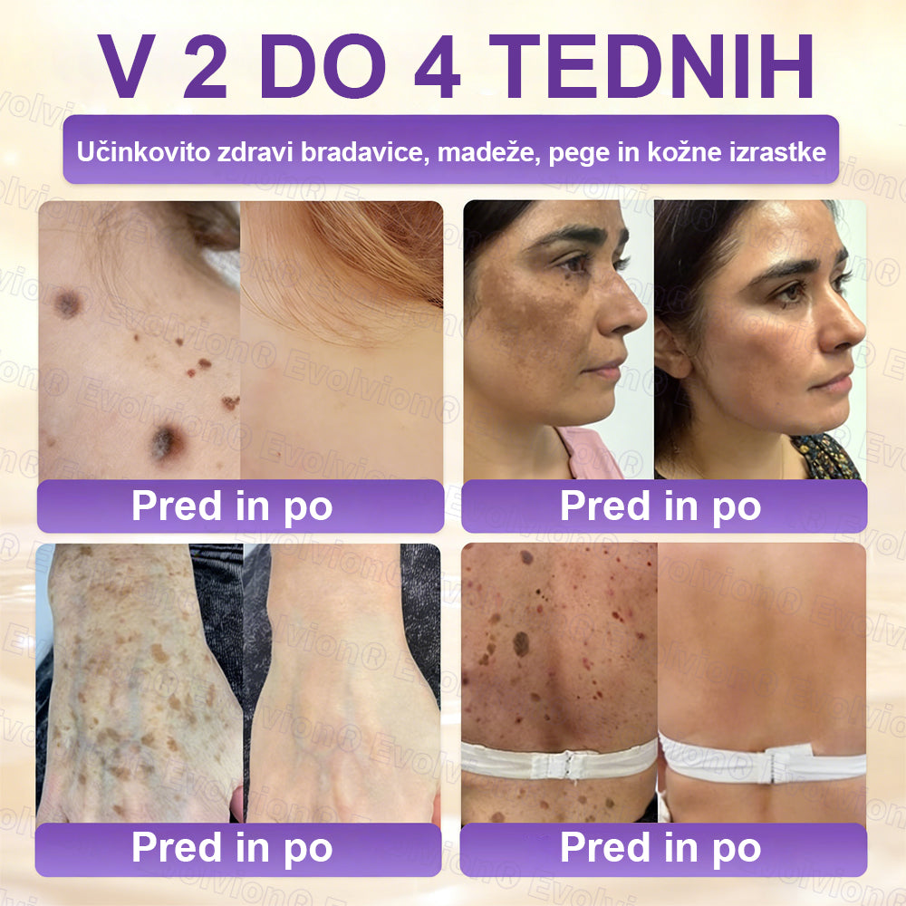 Tainun® Biotin 10-v-1 krema za obnovo kože ✨ proti staranju, luskavici, aknam, brazgotinam, pigmentaciji, suhosti, vnetjem & intimnemu nelagodju 🌿 z naravnimi bioaktivnimi sestavinami 💧 za gladko, čvrsto & mladostno kožo 🌸