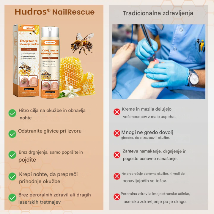 💥 2026 Omejeno 70 % CENEJE ️⏳ Hudros® NailRescue Kolirin pršilo proti glivicam s čebeljim strupom 💥 Vse težave z nohti lahko pozdravite v 2 tednih🐝