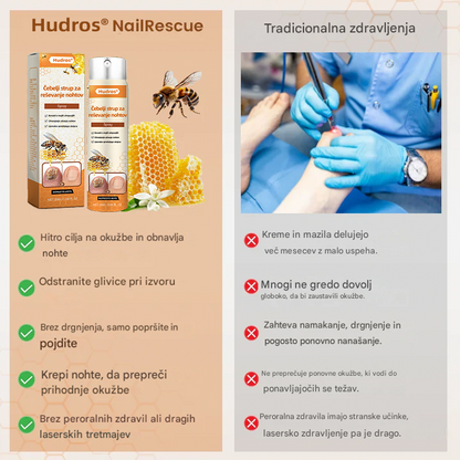 💥 2026 Omejeno 70 % CENEJE ️⏳ Hudros® NailRescue Kolirin pršilo proti glivicam s čebeljim strupom 💥 Vse težave z nohti lahko pozdravite v 2 tednih🐝