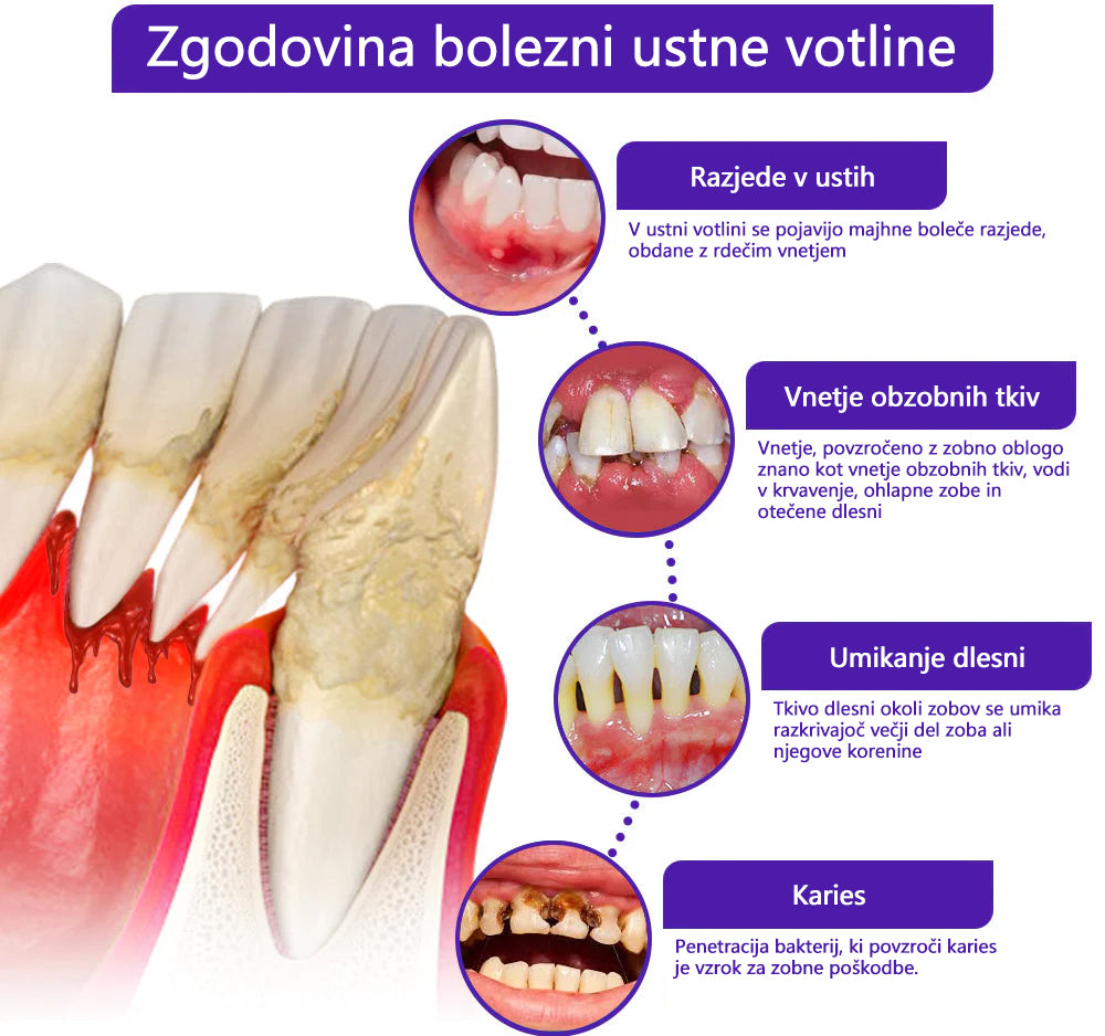 🌟 Twisma® VioCore Propolis zobna pasta 🦷 Olajšanje zobobola v 3 dneh · 7-dnevna obnova dlesni · Preprečevanje parodontalne bolezni · Popolna kombinacija čebeljega strupa in naravnih mineralov 🌟
