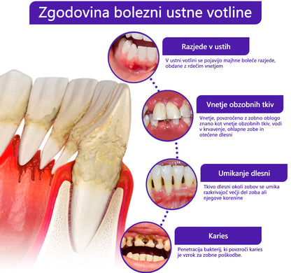🌟 Twisma® VioCore Propolis zobna pasta 🦷 Olajšanje zobobola v 3 dneh · 7-dnevna obnova dlesni · Preprečevanje parodontalne bolezni · Popolna kombinacija čebeljega strupa in naravnih mineralov 🌟