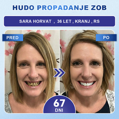 Guxar® Tideglusib Oralni Trakovi 🦷 – Aktivacija matičnih celic🧬, regeneracija dentina💎, krepitev sklenine⚡, beljenje zob✨, zmanjšanje občutljivosti💧, mikronadliki serum za zobe in dlesni💖, nežna vsakodnevna uporaba🌿