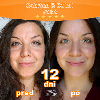✨ Pureo® revitalizacijska esenčna krema z matičnimi celicami, EGF in bakrovimi peptidi 💧 Spodbuja regeneracijo kože 🌿 Učvrsti in zgladi kožo ✨ Za bolj mladosten videz 💖