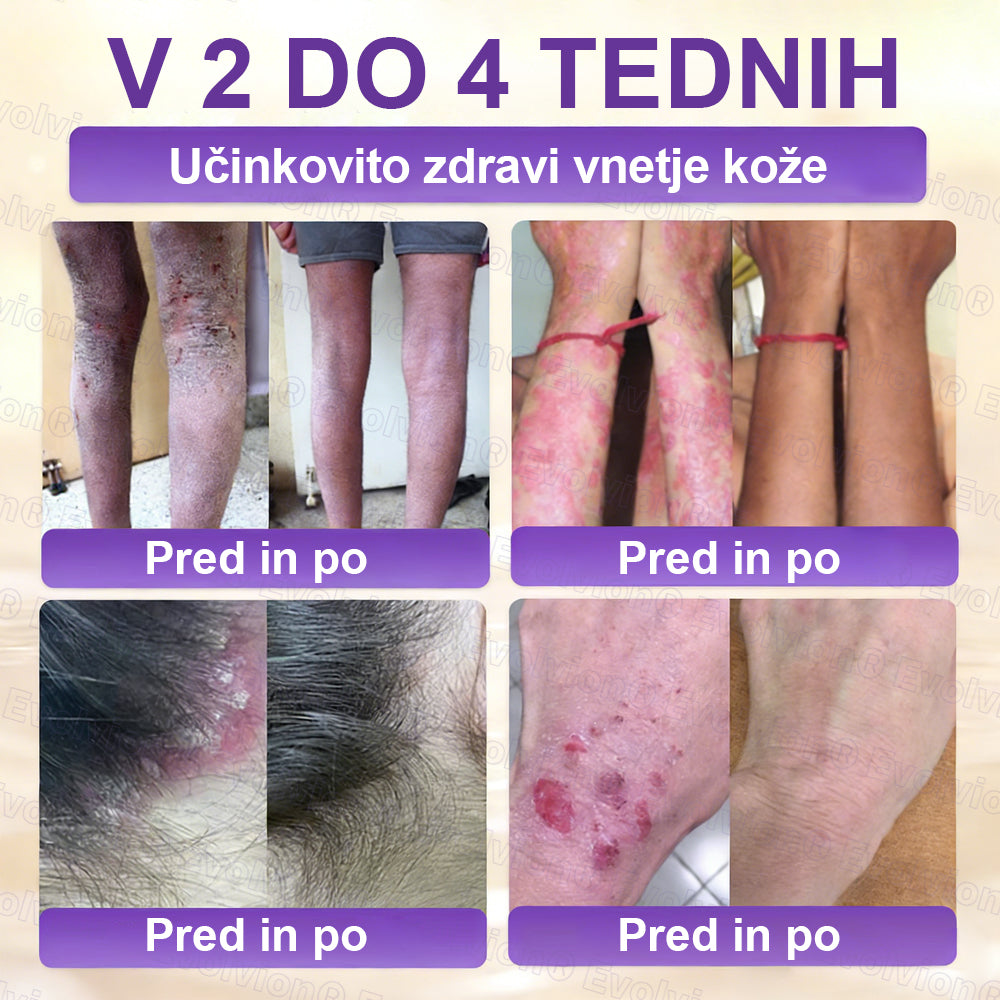 Tainun® Biotin 10-v-1 krema za obnovo kože ✨ proti staranju, luskavici, aknam, brazgotinam, pigmentaciji, suhosti, vnetjem & intimnemu nelagodju 🌿 z naravnimi bioaktivnimi sestavinami 💧 za gladko, čvrsto & mladostno kožo 🌸