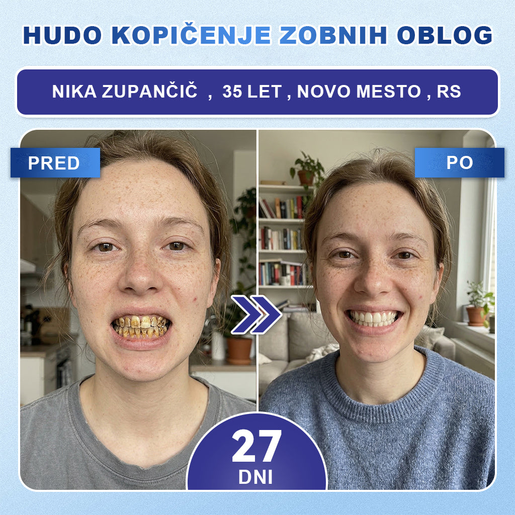 Guxar® Tideglusib Oralni Trakovi 🦷 – Aktivacija matičnih celic🧬, regeneracija dentina💎, krepitev sklenine⚡, beljenje zob✨, zmanjšanje občutljivosti💧, mikronadliki serum za zobe in dlesni💖, nežna vsakodnevna uporaba🌿
