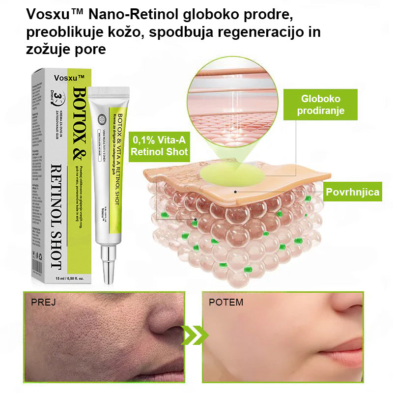 Vosxu™ Botox & Vita-A Retinol Shot serum za lifting gub ✨ – 💉 Mikro-Iglice | 💪 Peptidi z Učinkom Botoksa | 🌿 Retinol | ⚡ Vidni Rezultati v 3 Dneh