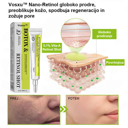 Vosxu™ Botox & Vita-A Retinol Shot serum za lifting gub ✨ – 💉 Mikro-Iglice | 💪 Peptidi z Učinkom Botoksa | 🌿 Retinol | ⚡ Vidni Rezultati v 3 Dneh
