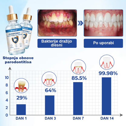 🌿🐝 Gingiora® Oral Heal Drops – naravne kapljice za nego dlesni in ustne votline | Za občutljive, razdražene in krvaveče dlesni ✨🦷