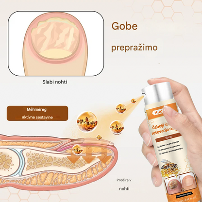 💥 2026 Omejeno 70 % CENEJE ️⏳ Hudros® NailRescue Kolirin pršilo proti glivicam s čebeljim strupom 💥 Vse težave z nohti lahko pozdravite v 2 tednih🐝