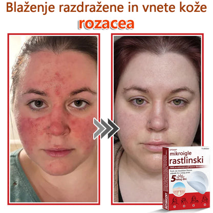 GFOUK® Rastlinski Mikronidling obliži za odstranjevanje kožnih izrastkov✨ – 🩹 Neboleče | 🚫 Brez Brazgotin | 🌿 Naravne Mikroiglice | 🎯 Globinsko Delovanje | 🛡️ Varno za Občutljivo Kožo | 📦 9 kosov | 🇪🇺 Medicinski Razred I |
