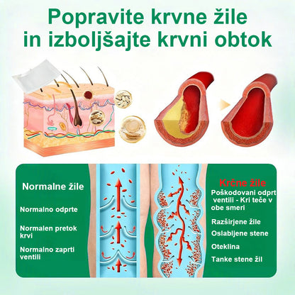 Posebna ponudba: do 70 % popusta! 🎁 Twisma® VeinTarget – napredni mikroobliž za krčne žile 🔥 96 % klinično dokazana učinkovitost ⚡ Vidni rezultati že v 7–14 dneh 🌿 Nežen podporni učinek za lažje in sproščene noge 🦵💪