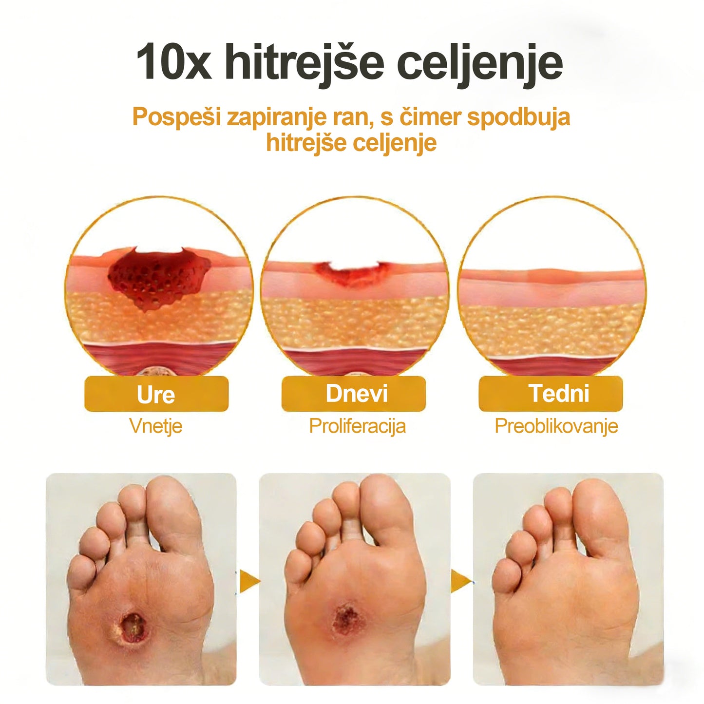 🏆 Najbolj prodajano 🔥 | Tainun® GlucoShield Čebelji strup pršilo za nego ran 🎉 Posebni časovno omejeni popust – ne zamudite!