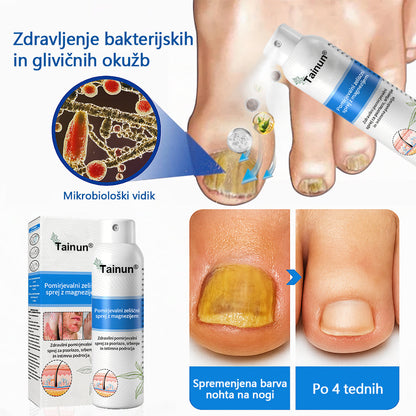 Tainun® Magnezijev zeliščni sprej ✅ CE certifikat – za zdravljenje luskavice (lajšanje luskavice in ekcemov, izboljšanje bakterijskih okužb genitalnega območja, zdravljenje aken in bradavic, lajšanje bolečin v sklepih in nevropatskih bolečin)✨