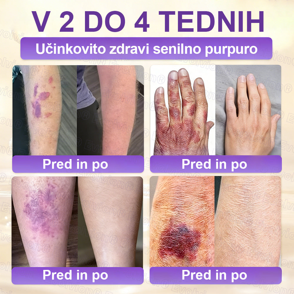 Tainun® Biotin 10-v-1 krema za obnovo kože ✨ proti staranju, luskavici, aknam, brazgotinam, pigmentaciji, suhosti, vnetjem & intimnemu nelagodju 🌿 z naravnimi bioaktivnimi sestavinami 💧 za gladko, čvrsto & mladostno kožo 🌸