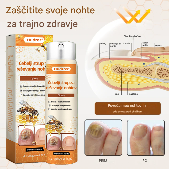💥 2026 Omejeno 70 % CENEJE ️⏳ Hudros® NailRescue Kolirin pršilo proti glivicam s čebeljim strupom 💥 Vse težave z nohti lahko pozdravite v 2 tednih🐝