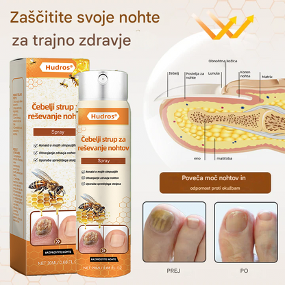 💥 2026 Omejeno 70 % CENEJE ️⏳ Hudros® NailRescue Kolirin pršilo proti glivicam s čebeljim strupom 💥 Vse težave z nohti lahko pozdravite v 2 tednih🐝